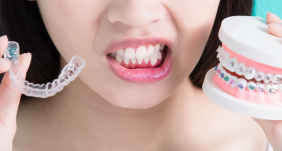 Why More People Are Choosing Invisible Braces Over Traditional Braces